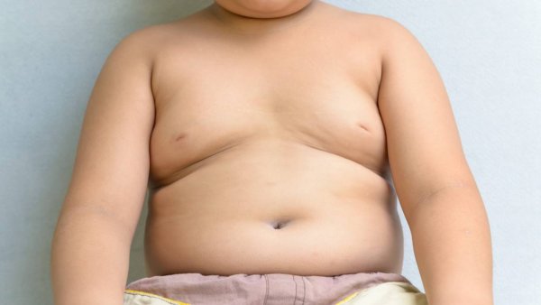 Ученые: Подростки с ожирением имеют больше проблемы со здоровьем в будущем